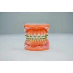 Ortodonție (aparat dentar)