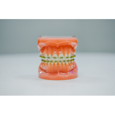 Ortodonție (aparat dentar)